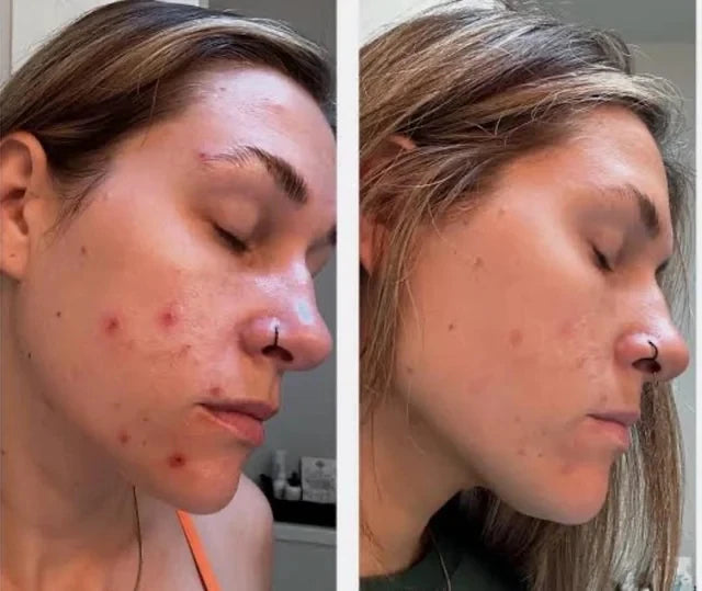 Beef Tallow Face Cream