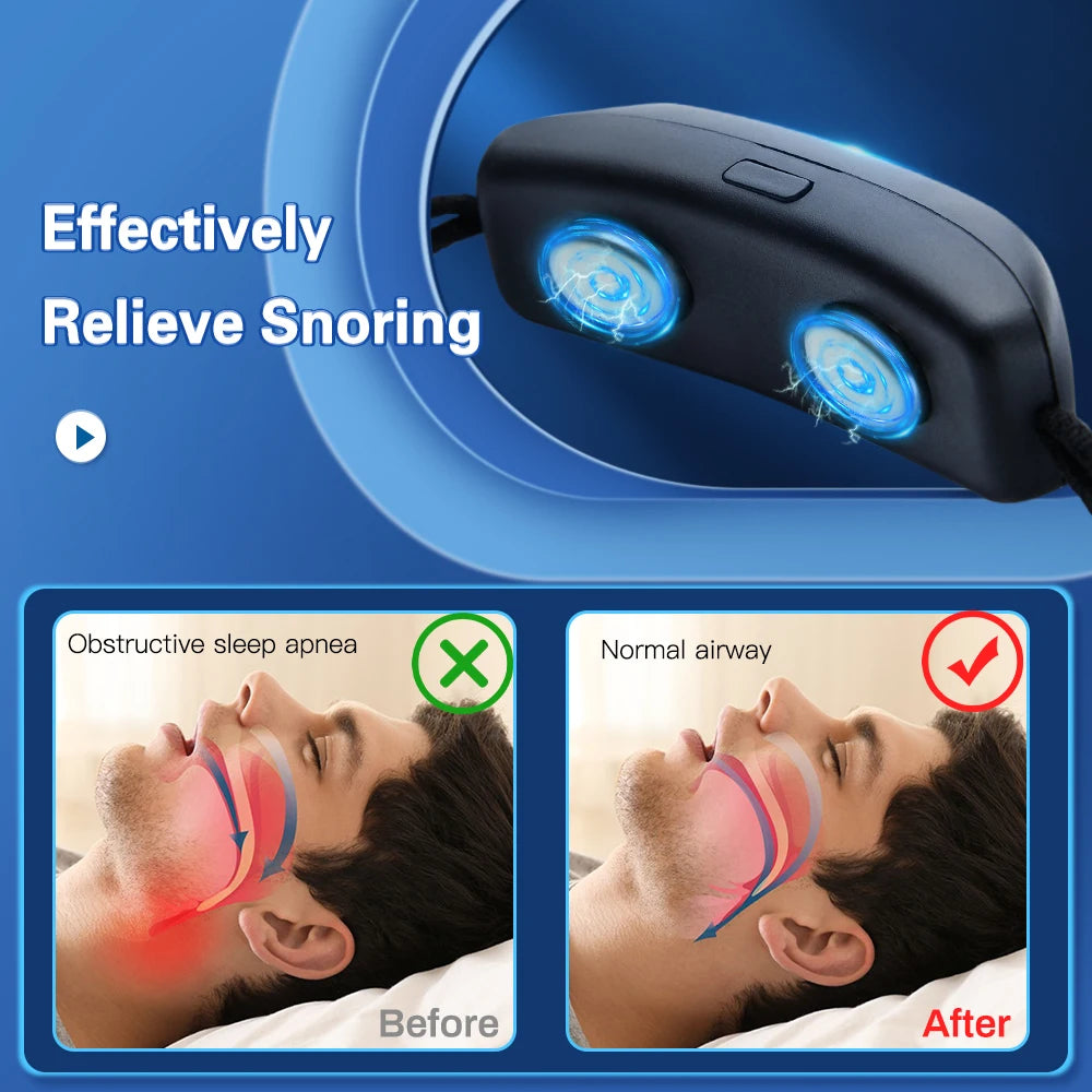 EMS Anti-Snore Device
