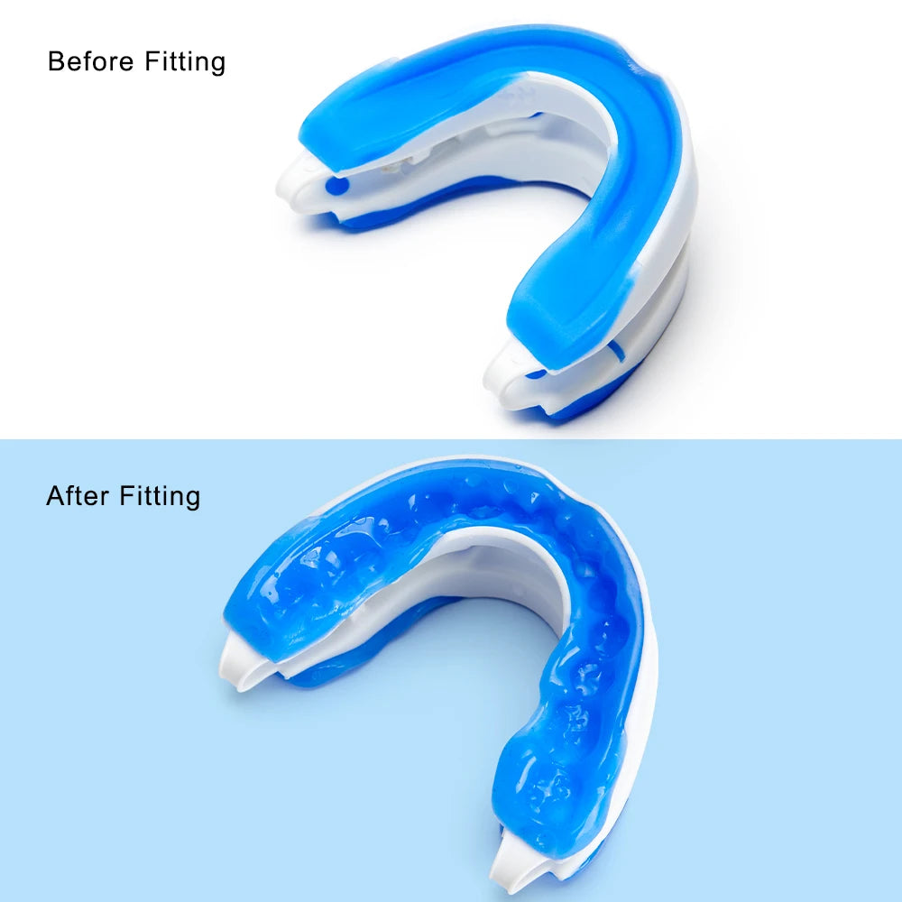 Anti-Snore Silicone Mouth Guard