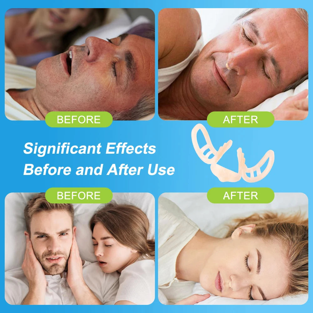 Anti-Snore Nasal Clip