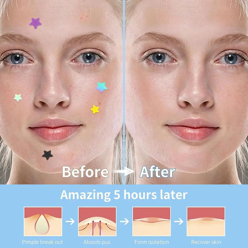 Colorful Star Pimple Patch