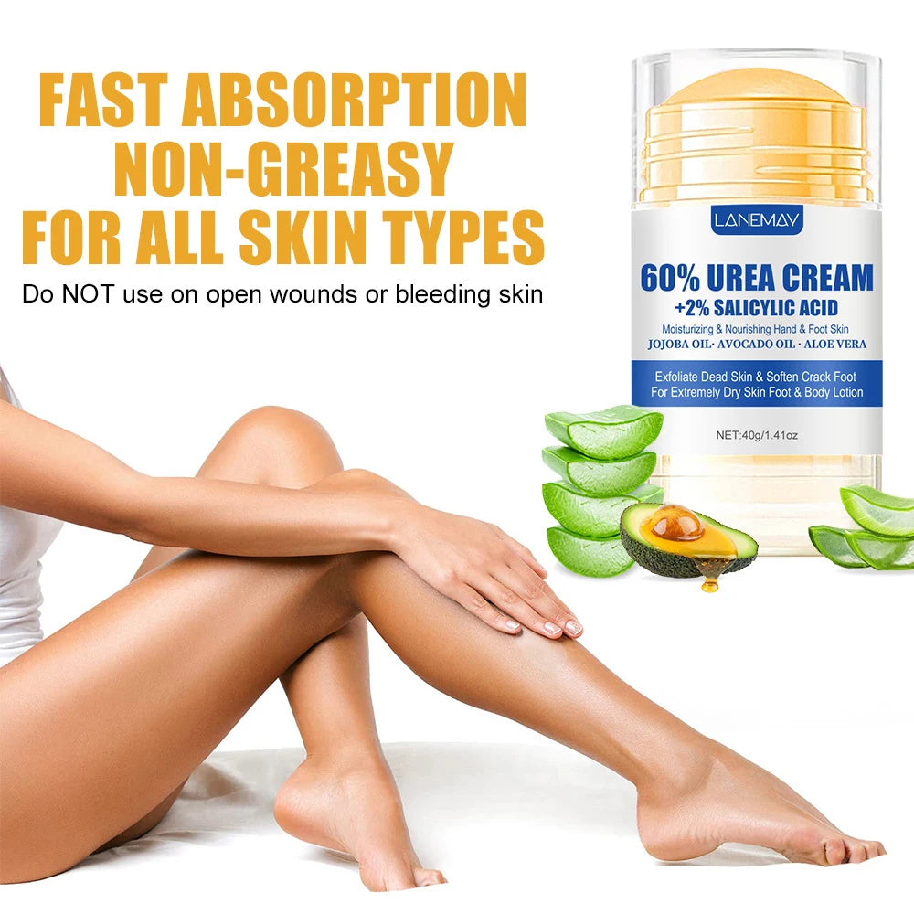 60% Urea Aloe Foot Cream
