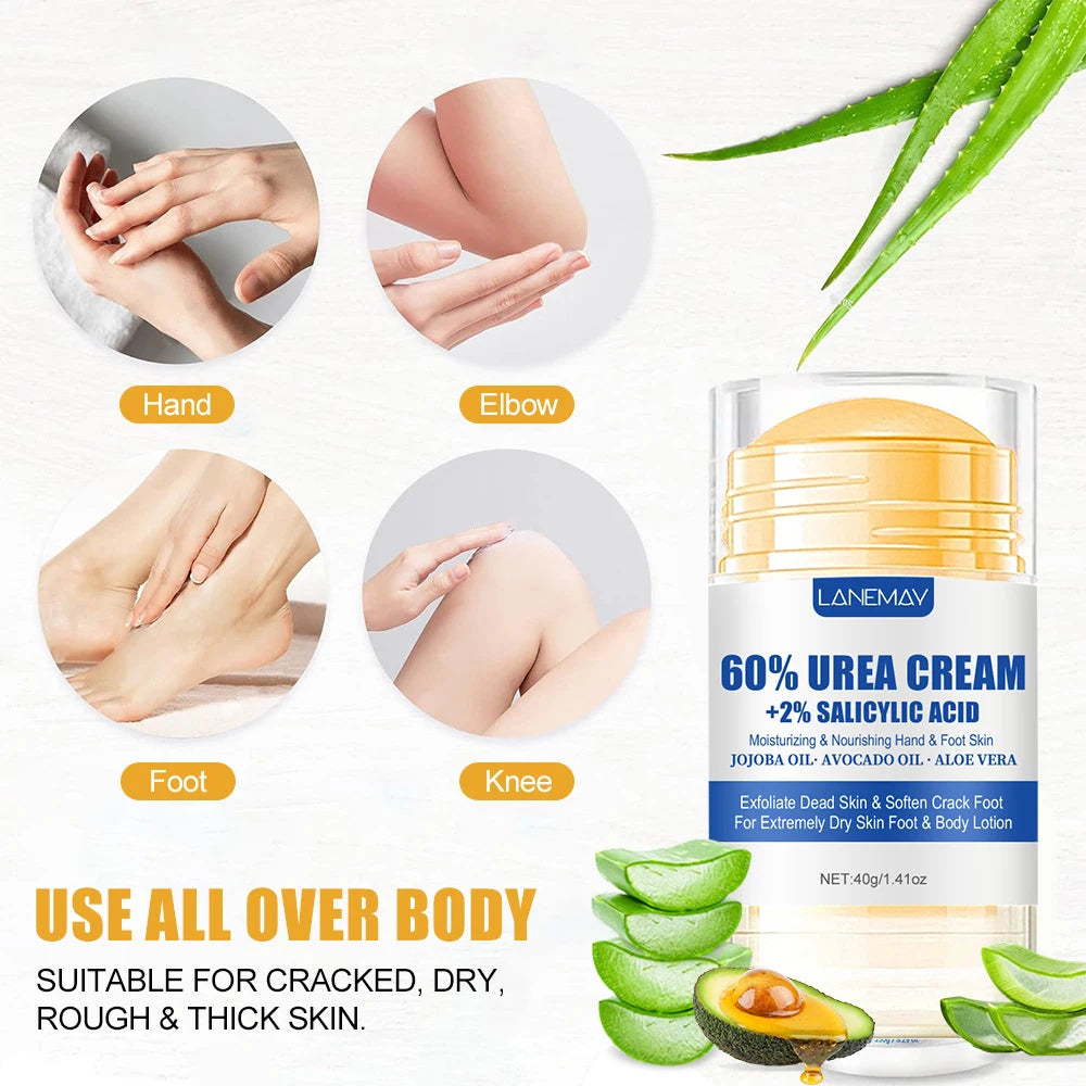 60% Urea Aloe Foot Cream