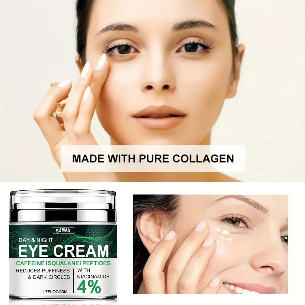 Nicotinamide Eye Cream for Dark Circles and Puffiness with Hyaluronic Acid