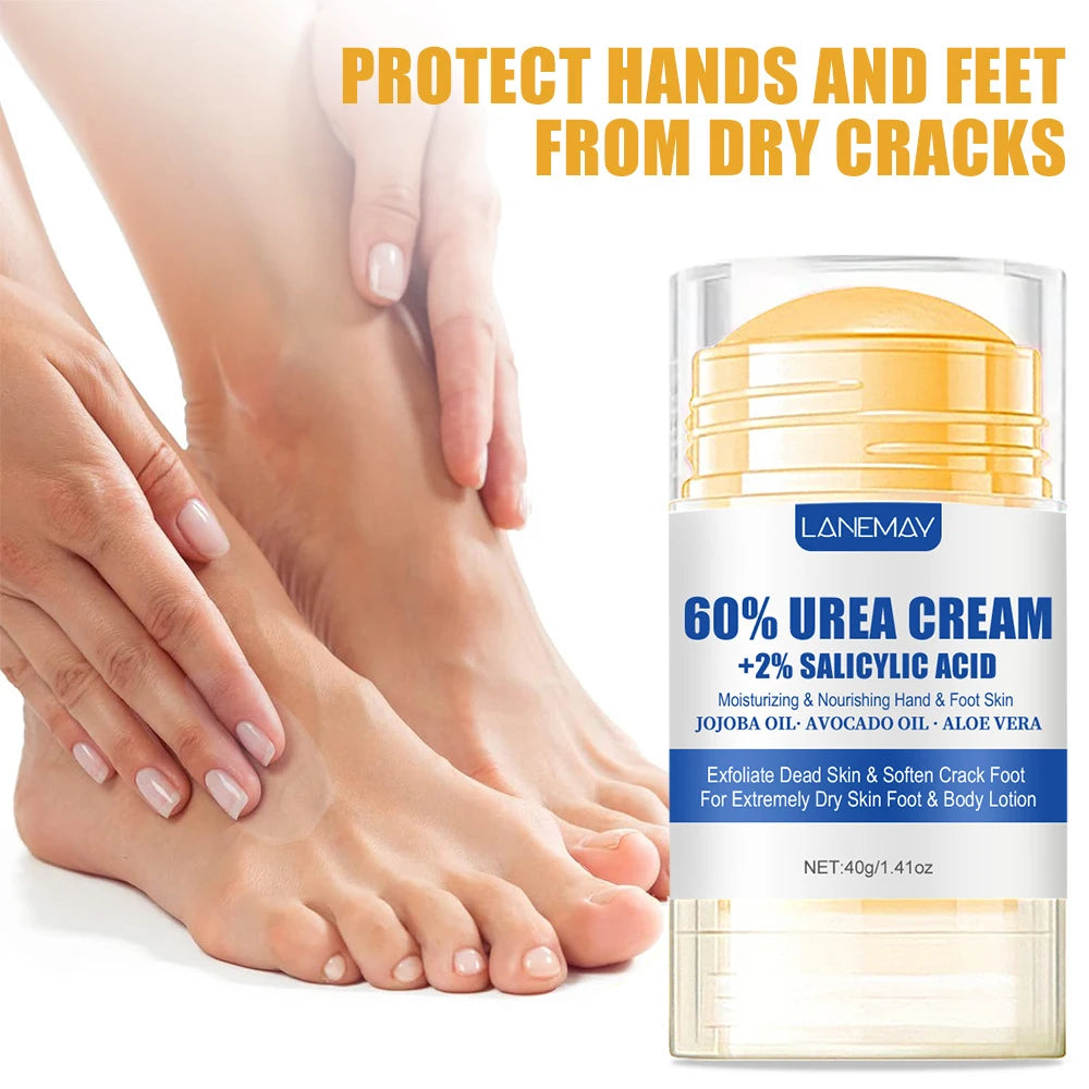 60% Urea Aloe Foot Cream