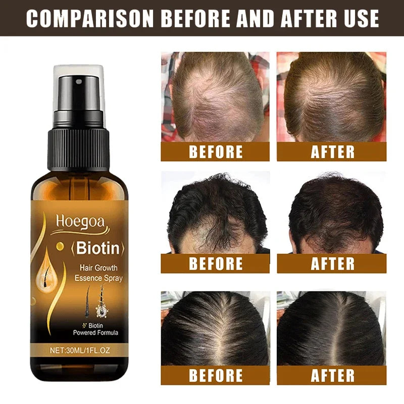 Biotin Growth Serum Spray
