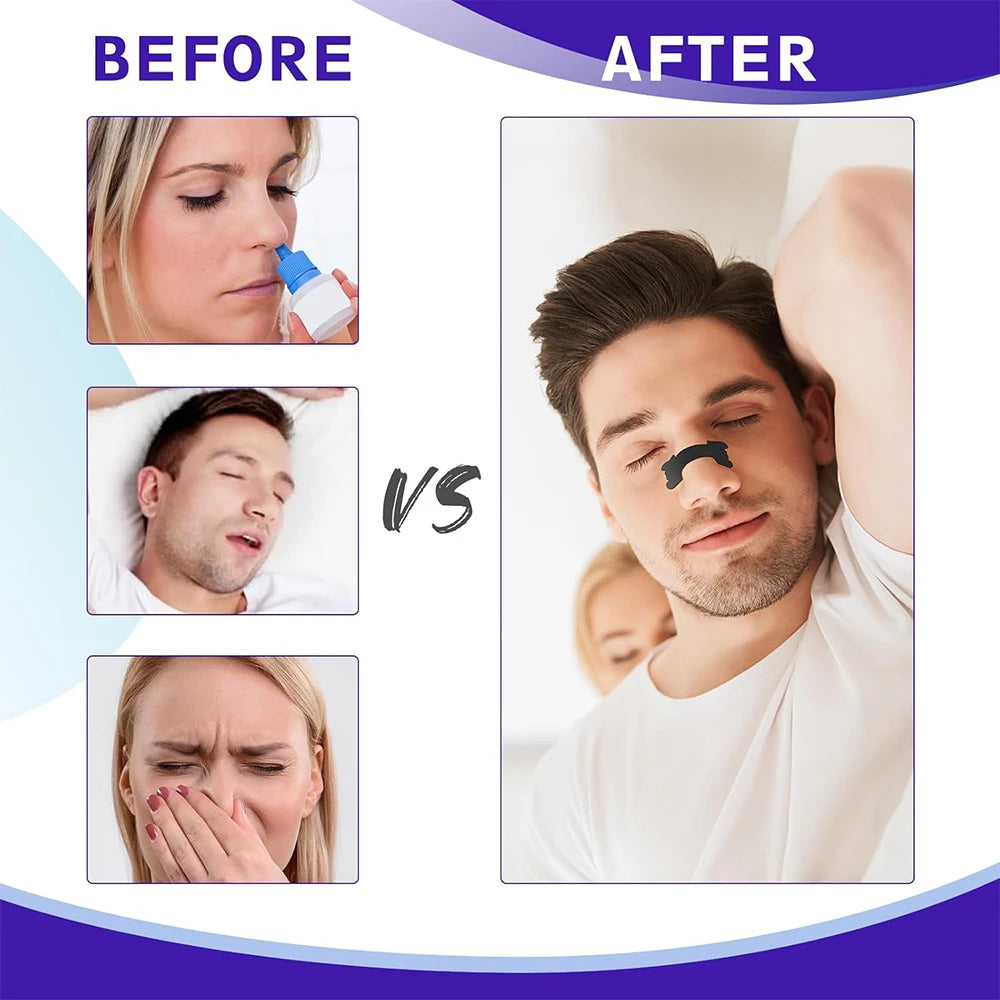 Black Nose Strips Extra Strength Anti Snoring Nasal Strips for Better Sleep