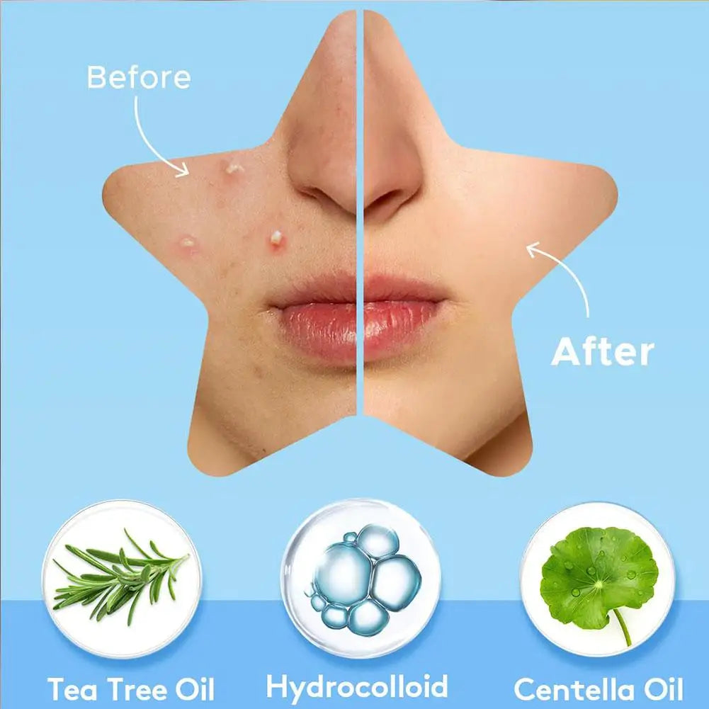 Colorful Star Pimple Patch